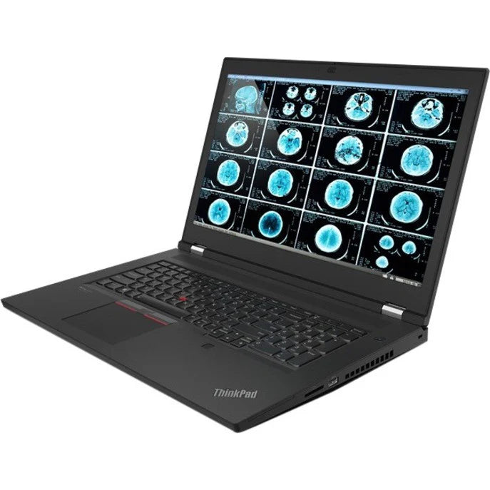 Lenovo ThinkPad P17 G2 20YU001RUS 17.3" Mobile Workstation - Full HD - 1920 x 1080 - Intel Core i7 11th Gen i7-11850H Octa-core (8 Core) 2.50 GHz - 32 GB RAM - 1 TB SSD - Black 20YU001RUS